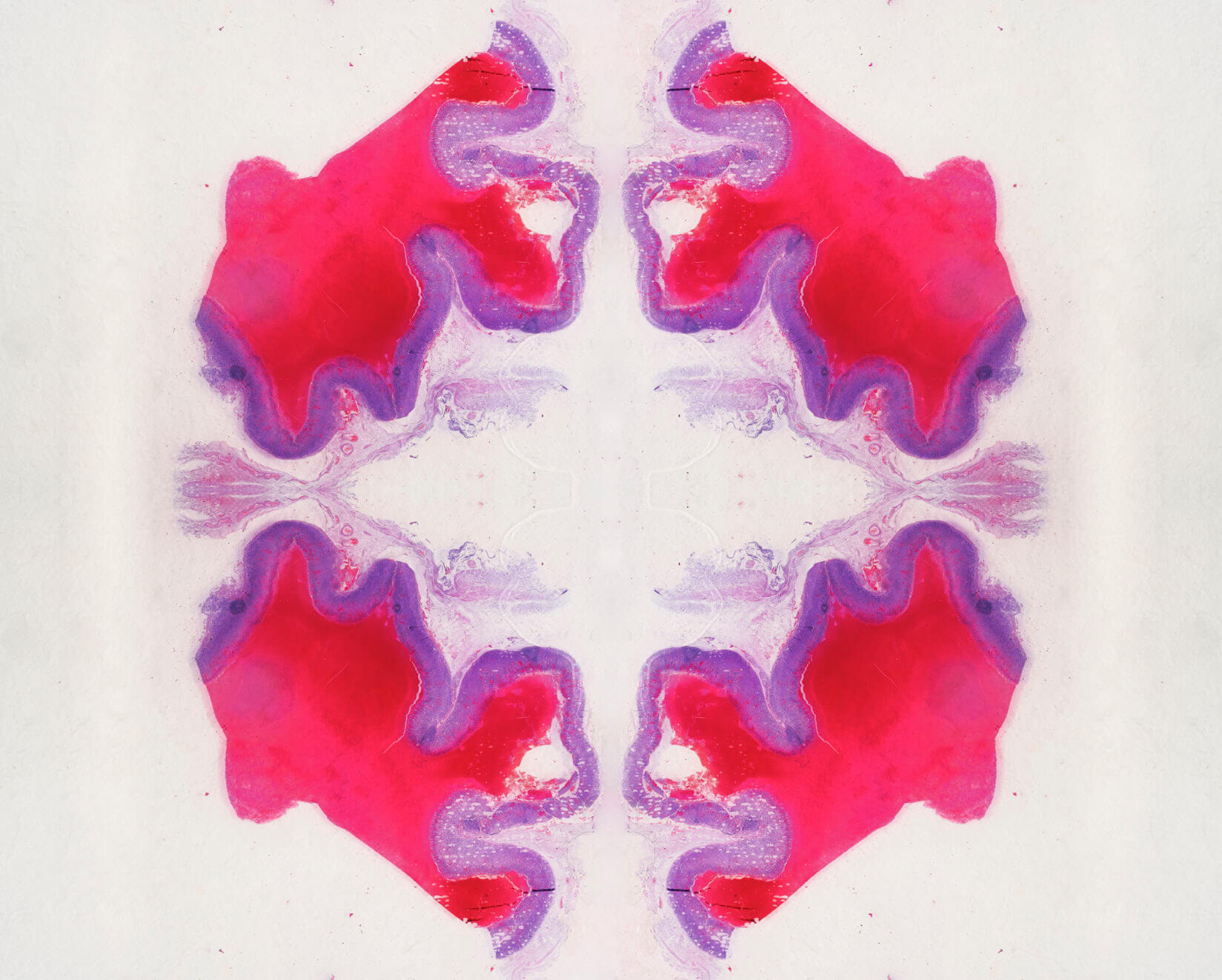 analiza medicina personalizada