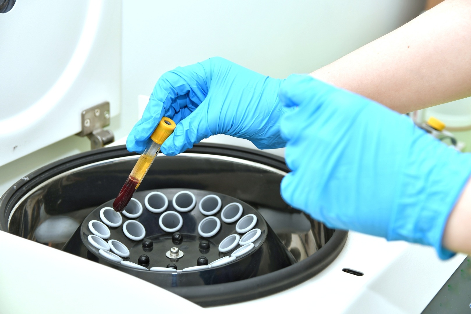 Profesional manipulando muestras de sangre en una centrifugadora en relación al área de coagulación