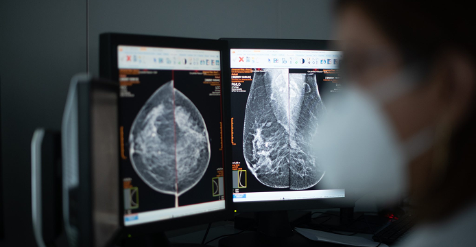 Diagnóstico por imagen visto por un profesional sanitario