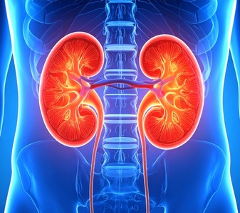 Preparación para la recogida de cálculo renal | Analiza