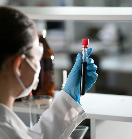 Profesional sanitario analizando una muestra de sangre en laboratorio para una analítica completa